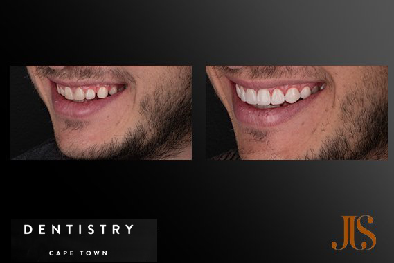 Cosmetic Dentistry South Africa