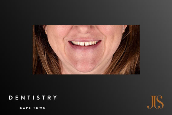 Cosmetic Dentist Cape Town