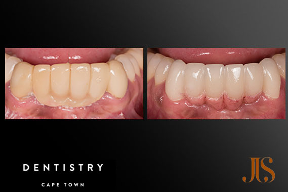 Cosmetic Dentistry Cape Town Cosmetic Dentistry