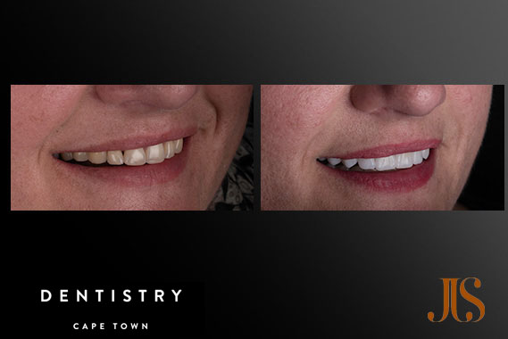 Cosmetic Dentistry