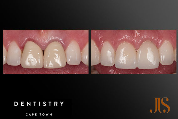 Cosmetic Dentist Cape Town Cosmetic Dentistryn