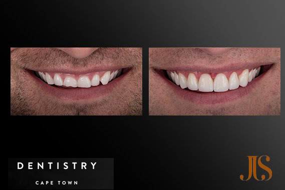 Cosmetic Dentistry South Africa