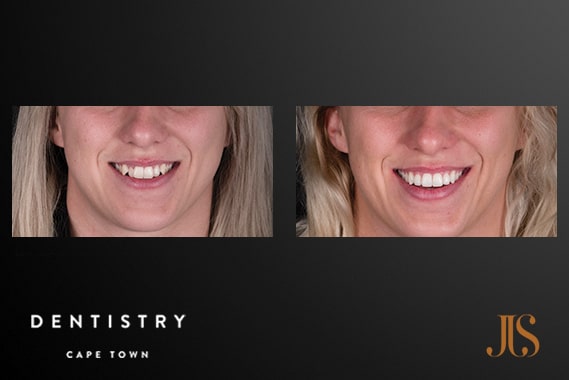 Orthodontist | Dr JJ Serfontein