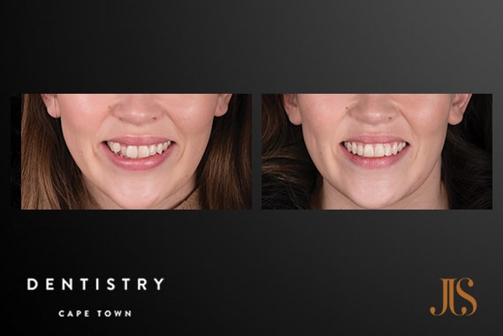 Cape Town Orthodontist | Dr JJ Serfontein