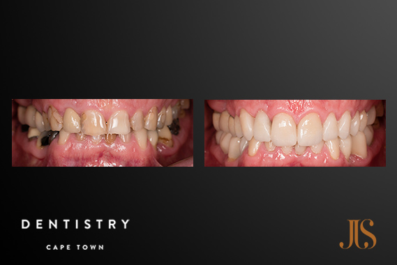 Cape Town Comprehensive Reconstructive Dentistry