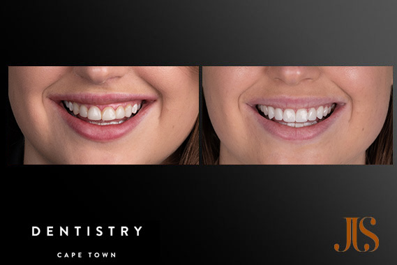 Cosmetic Dentistry