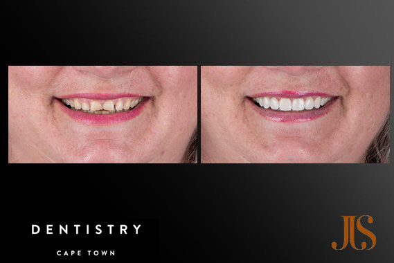 Cosmetic Dentistry