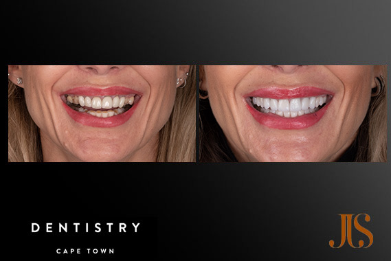 Cosmetic Dentistry