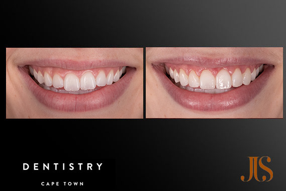 Cosmetic Dentistry