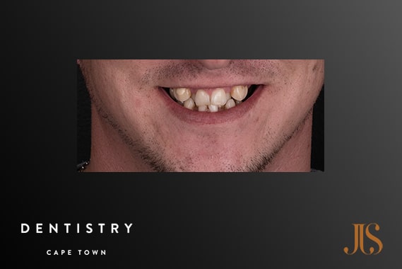 Cosmetic Dentistry Cape Town