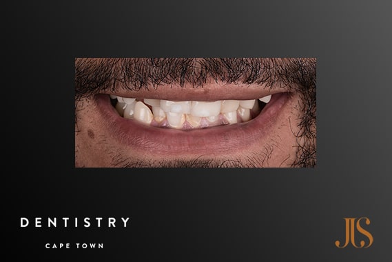 Cosmetic Dentistry Cape Town