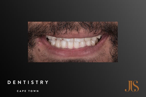 Cosmetic Dentistry Cape Town