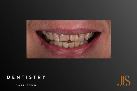 Cosmetic Dentistry Cape Town