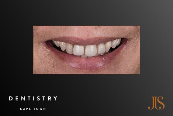 Cosmetic Dentist Cape Town