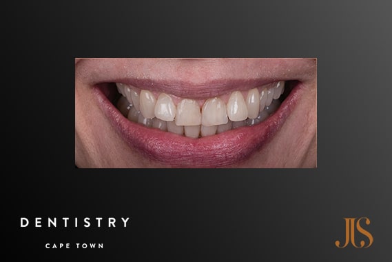 Cosmetic Dentist Cape Town