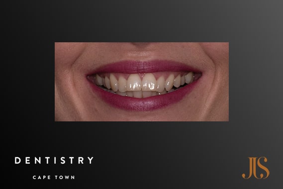 Cosmetic Dentist Cape Town