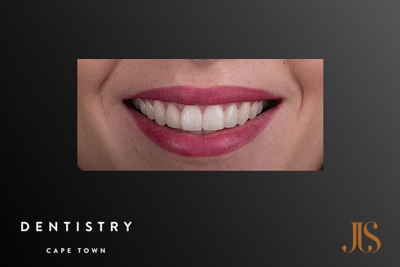 Cosmetic Dentistry Cape Town