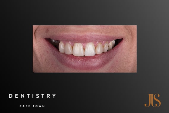 Cosmetic Dentist Cape Town