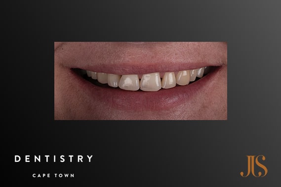 Cosmetic Dentist Cape Town