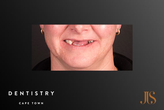 Cosmetic Dentistry Cape Town