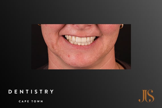 Cosmetic Dentistry Stellenbosch