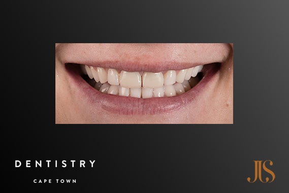Cosmetic Dentistry Cape Town