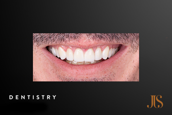 Cosmetic Dentistry Cape Town