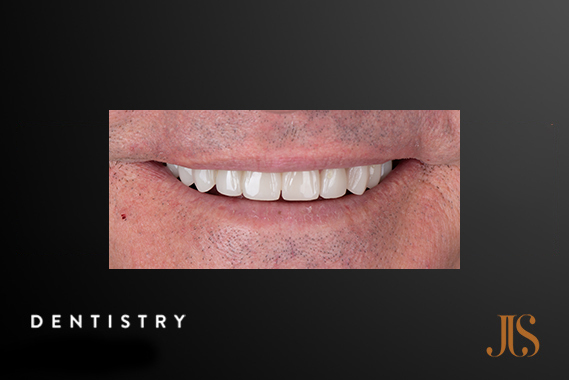 Cosmetic Dentistry Cape Town