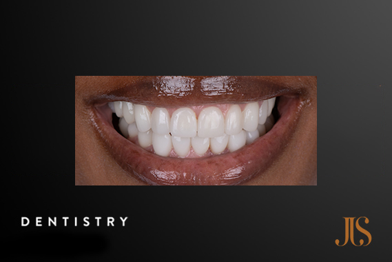 Cosmetic Dentistry Cape Town