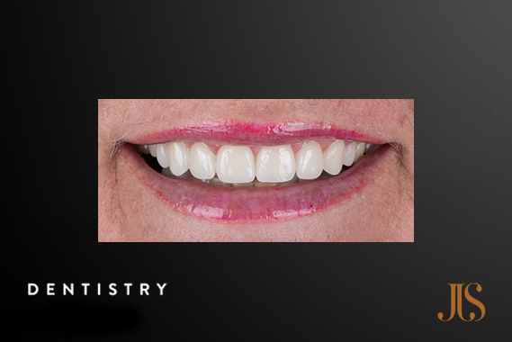 Cosmetic Dentistry Cape Town
