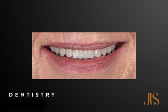 Cosmetic Dentistry Cape Town