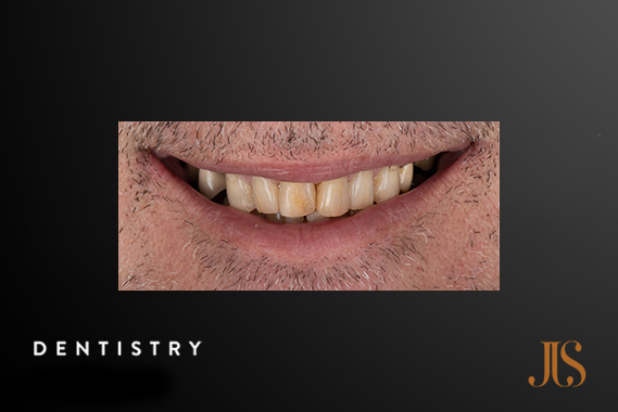 Cosmetic Dentist Cape Town