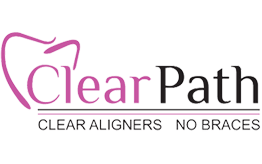 Clear Path Aligners