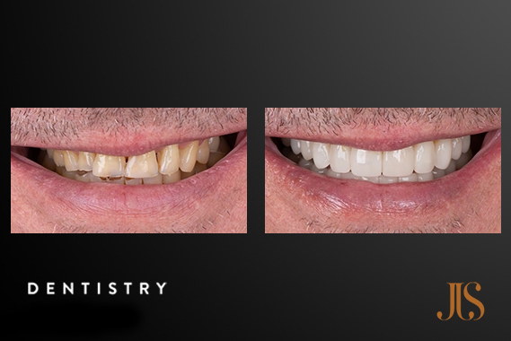 Cosmetic Dentistry