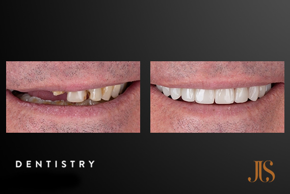 Cosmetic Dentistry