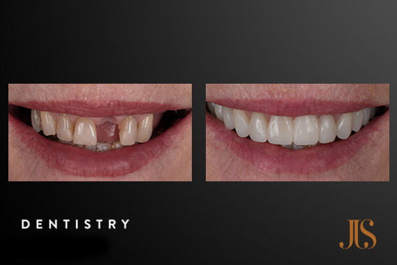 Cosmetic Dentistry