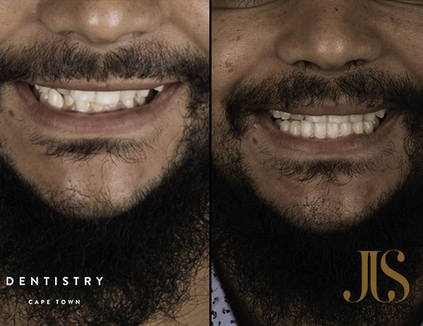 Orthodontist Cape Town | JJS Dentistry