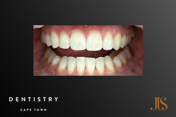 Cosmetic Dentistry Stellenbosch