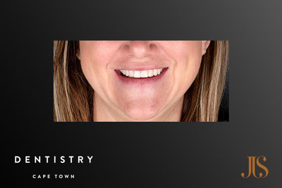 Cosmetic Dentistry Stellenbosch