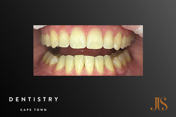 Cosmetic Dentist Stellenbosch