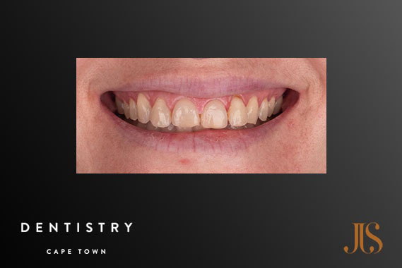 Cosmetic Dentist Stellenbosch