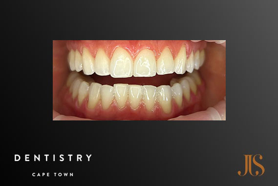 Cosmetic Dentist Stellenbosch