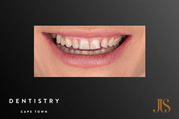 Cosmetic Dentist Stellenbosch