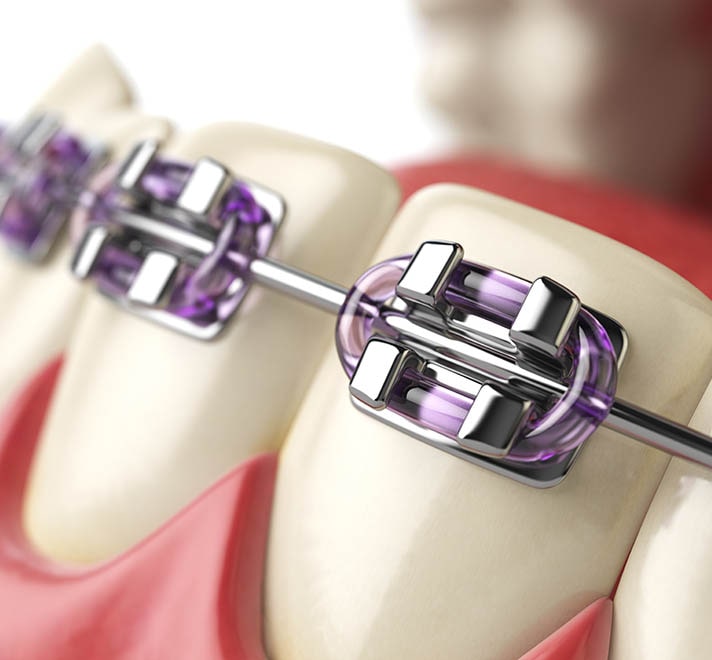 Orthodontics Cape Town